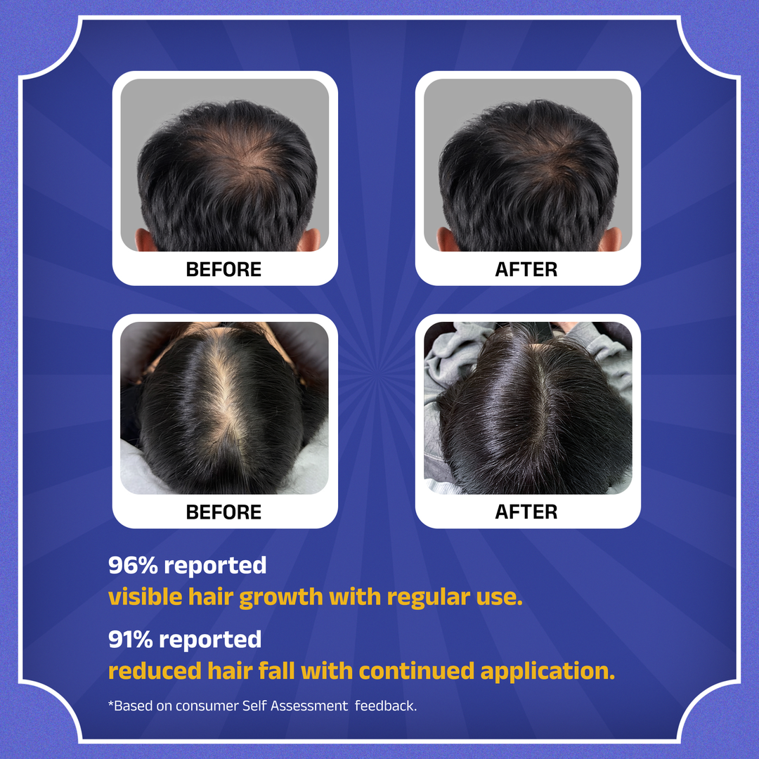Rockstar Advanced Hair Growth Serum - Image 12